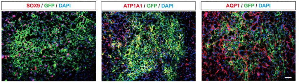 The Silent Synergy: Stem Cell Therapy Rekindling Hope in Diabetic Kidney Disease 3 Intrarenal transplantation of SOX9+CD73+ human renal progenitor cells